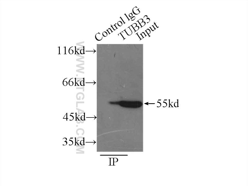 IP Result of anti-tubulin-beta (IP:10094-1-AP, 3ug; Detection:10094-1-AP 1:1000) with  mouse brain tissue lysate 7500ug.