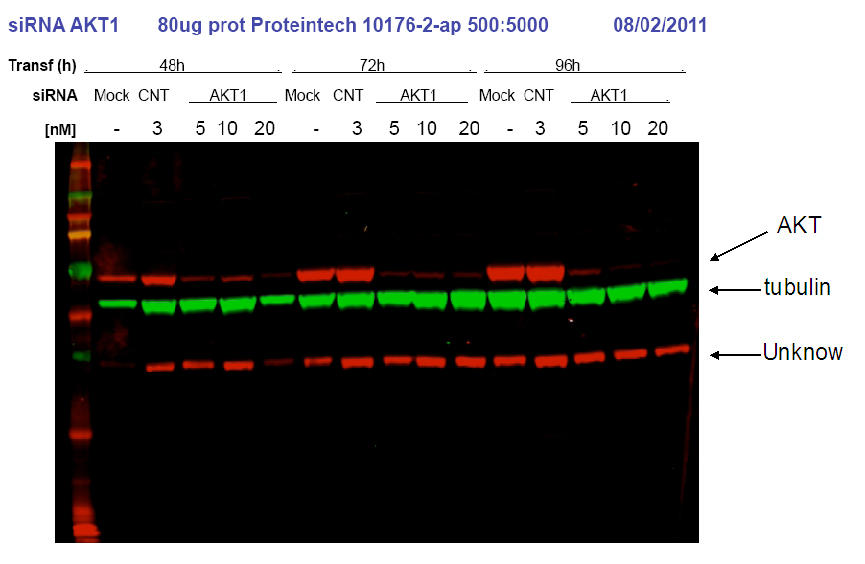siRNA AKT1 result from Dr. Eva Martinez-Balibrea. Green:tubulin, Red:10176-2-AP, AKT1.