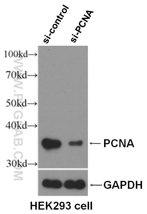 WB result of PCNA antibody (10205-2-AP, 1:10000) with si-control and si-PCNA transfected HEK293 cells.