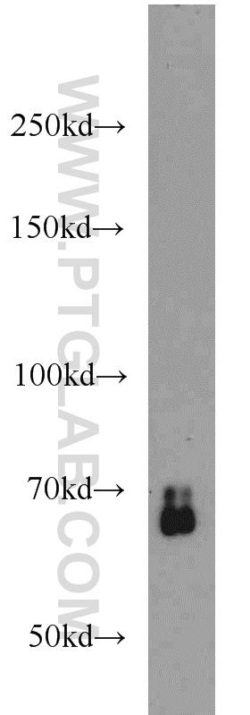 HEK-293 cells were subjected to SDS PAGE followed by western blot with 10231-1-AP(SMAD4 antibody) at dilution of 1:600  incubated at room temperature for 1.5 hours