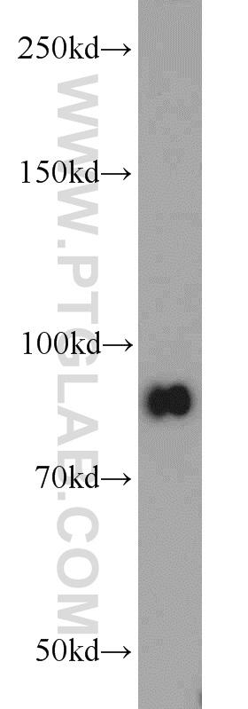 HeLa cells were subjected to SDS PAGE followed by western blot with 10253-2-AP(STAT3 antibody) at dilution of 1:4000  incubated at room temperature for 1.5 hours