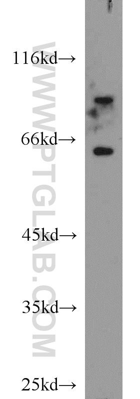 SH-SY5Y cells were subjected to SDS PAGE followed by western blot with 10274-1-AP(TAU antibody) at dilution of 1:1000  incubated at room temperature for 1.5 hours