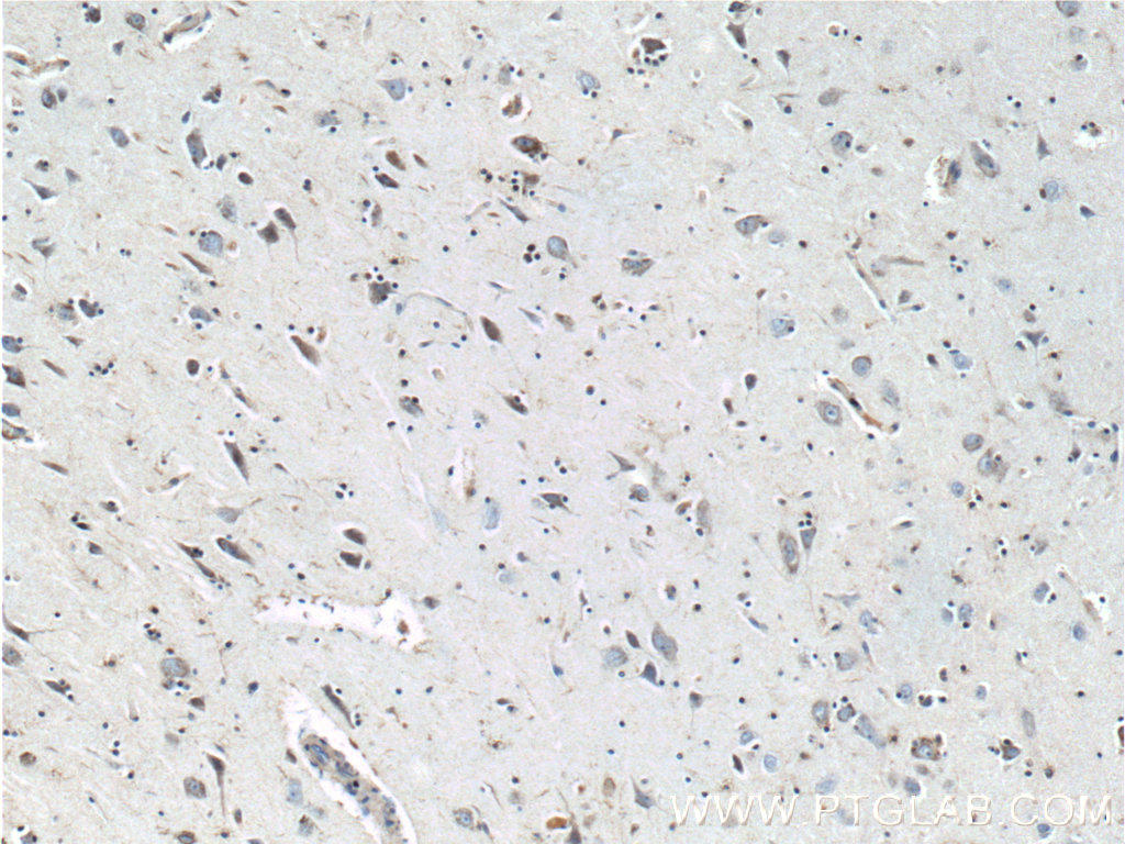 Immunohistochemistry of paraffin-embedded human brain tissue slide using 10274-1-AP( TAU Antibody) at dilution of 1:200 (under 10x lens)