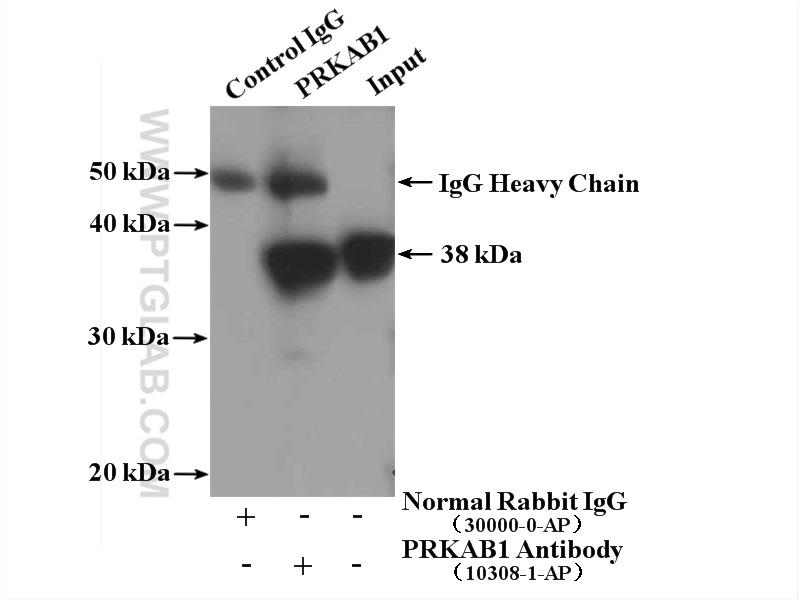 IP Result of anti-PRKAB1 (IP:10308-1-AP, 4ug; Detection:10308-1-AP 1:1000) with mouse liver tissue lysate 4000ug.