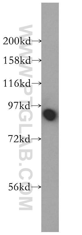 mouse brain tissue were subjected to SDS PAGE followed by western blot with 10427-2-AP(CANX antibody) at dilution of 1:400  incubated at room temperature for 1.5 hours
