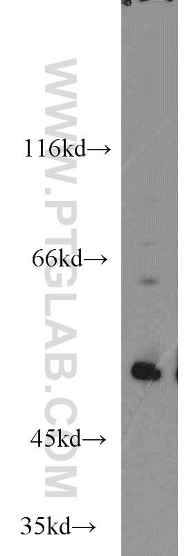 MCF7 cells were subjected to SDS PAGE followed by western blot with 10442-1-AP(P53 antibody) at dilution of 1:1000  incubated at room temperature for 1.5 hours