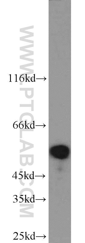 HEK-293 cells were subjected to SDS PAGE followed by western blot with 10746-1-AP(STK11 antibody) at dilution of 1:600  incubated at room temperature for 1.5 hours