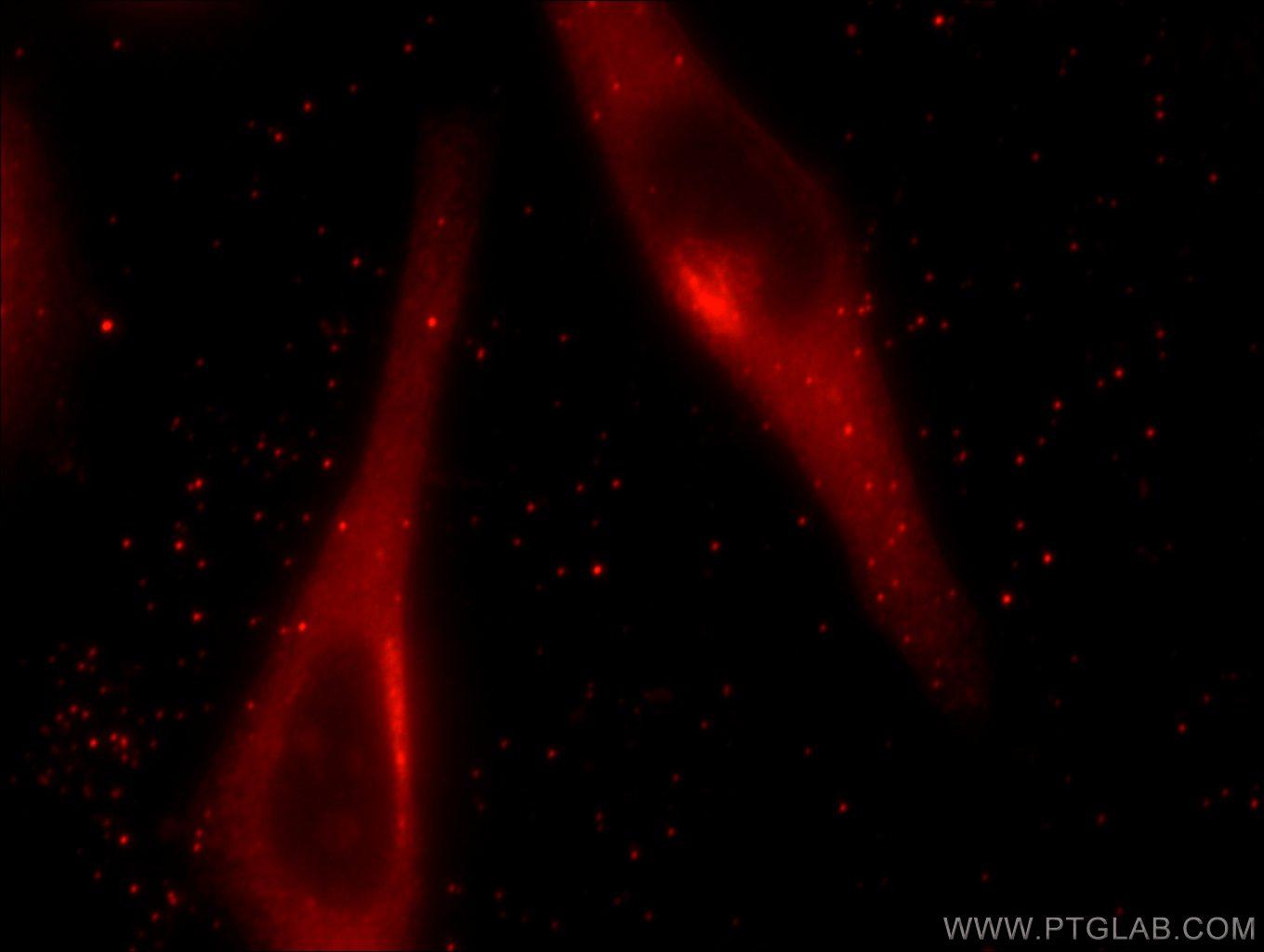 Immunofluorescent analysis of HeLa cells using 10747-2-AP( GRASP65,GORASP1 Antibody) at dilution of 1:25 and Rhodamine-Goat anti-Rabbit IgG