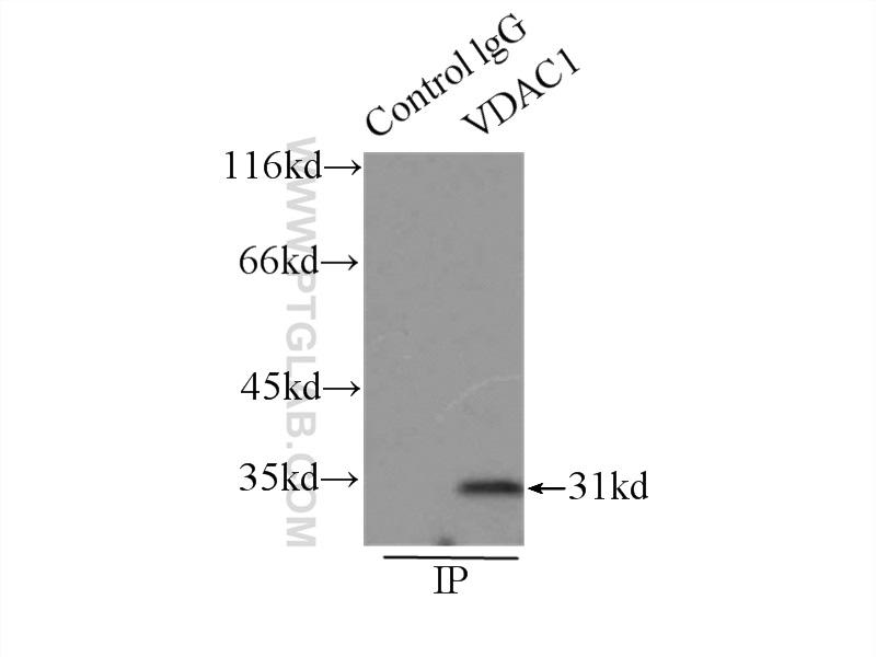 HEK293 細胞ライセートを SDS-PAGE で分離し、ウエスタンブロットで VDAC1 を検出した。