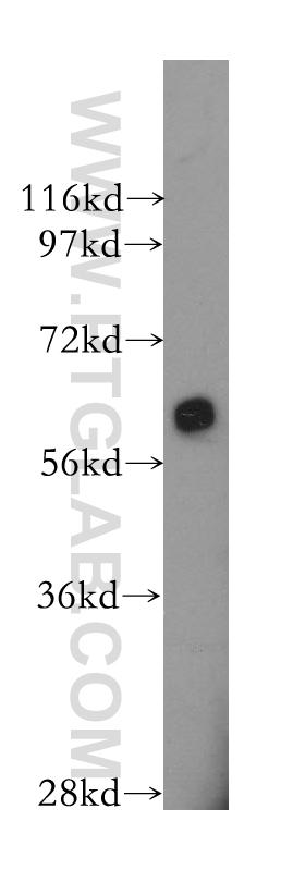HeLa cells were subjected to SDS PAGE followed by western blot with 10929-2-AP(PRKAA1 antibody) at dilution of 1:300  incubated at room temperature for 1.5 hours