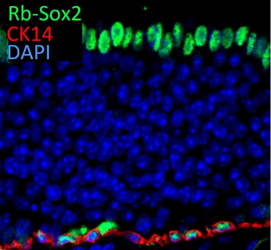 IF result of SOX2 antibody (11064-1-AP, 1:300) with 1% PLP fixed adult mouse olfactory epithelium.(Red:CK14; Green: SOX2; Blue: DAPI). By Brian Lin, Tufts University.