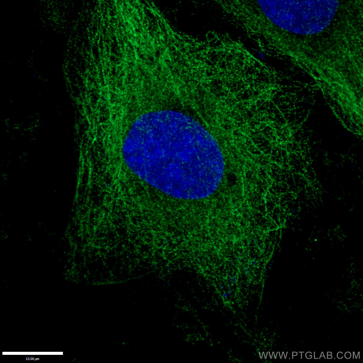 Alpha Tubulin 抗体 Aチューブリンを検出 ローディングコントロールに有用 モノクロ0報 ポリクロ400報以上の文献使用実績 コスモ バイオ株式会社