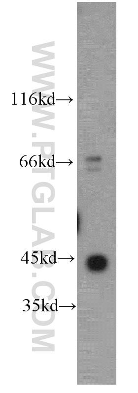 HeLa cells were subjected to SDS PAGE followed by western blot with 11227-1-AP(ACTG1 antibody) at dilution of 1:500  incubated at room temperature for 1.5 hours