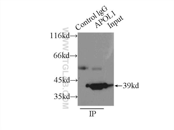 本抗体（IP:11486-2-AP, 3ug; Detection:11486-2-AP 1:500）を用いてHepG2細胞ライセート6000ugでIP（免疫沈降）を行った。