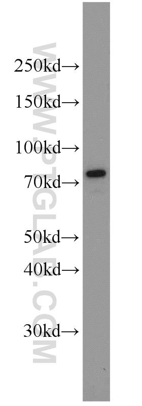 HepG2 cells were subjected to SDS PAGE followed by western blot with 11587-1-AP(GRP78,BIP antibody) at dilution of 1:1000  incubated at room temperature for 1.5 hours