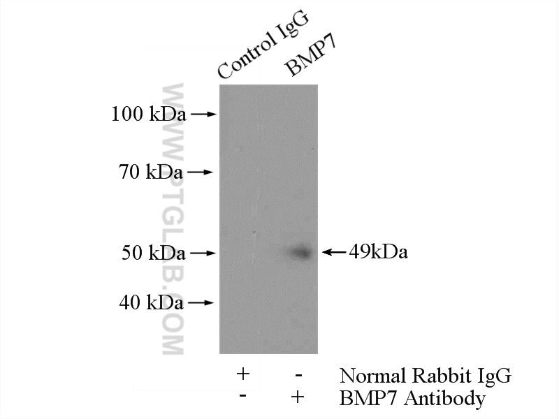 IP Result of anti-BMP7 (IP:12221-1-AP, 4ug; Detection:12221-1-AP 1:800) with HEK-293 cells lysate 2800ug.