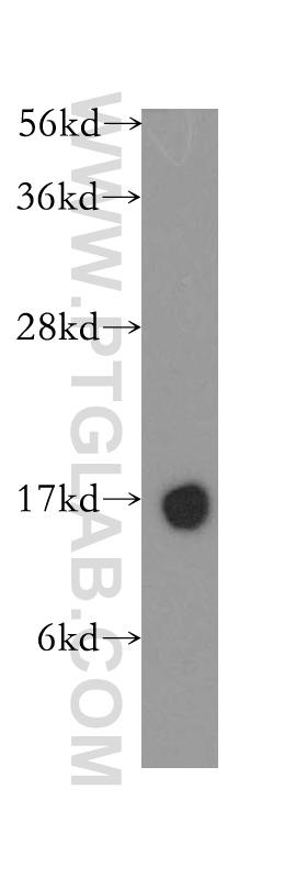 human brain tissue were subjected to SDS PAGE followed by western blot with 12245-1-AP(CST3 antibody) at dilution of 1:400  incubated at room temperature for 1.5 hours