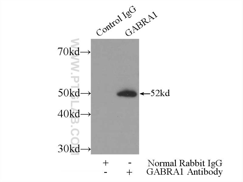 GABRA1 抗体 | コスモ・バイオ株式会社