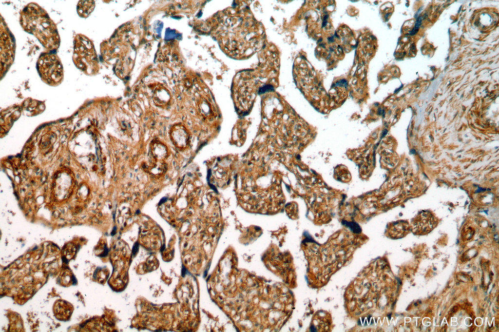 Immunohistochemical of  paraffin-embedded human placenta using 13398-1-AP(GPR161 antibody) at dilution of 1:50 (under 10x lens)