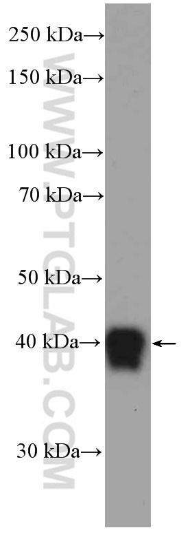  human plasma tissue were subjected to SDS PAGE followed by western blot with 13399-1-AP (Zinc-alpha-2-glycoprotein antibody) at dilution of 1:600  incubated at room temperature for 1.5 hours