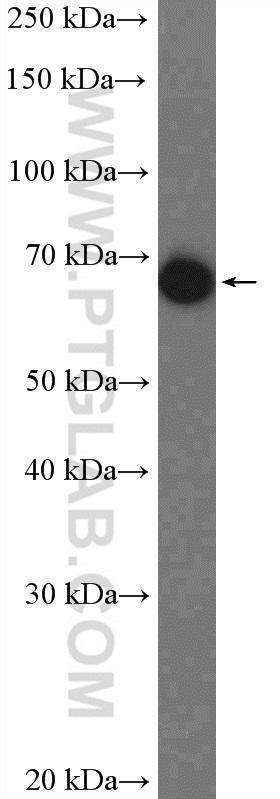 human plasma tissue were subjected to SDS PAGE followed by western blot with 14181-1-AP( A1BG Antibody) at dilution of 1:5000  incubated at room temperature for 1.5 hours