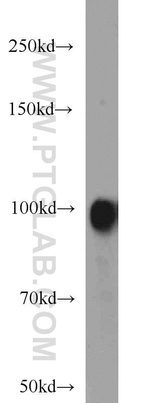 mouse brain tissue were subjected to SDS PAGE followed by western blot with 14243-1-AP(ENPP2 antibody) at dilution of 1:500  incubated at room temperature for 1.5 hours