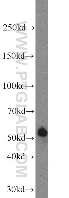COLO 320 cells were subjected to SDS PAGE followed by western blot with 14437-1-AP(TMPRSS2 antibody) at dilution of 1:1000  incubated at room temperature for 1.5 hours