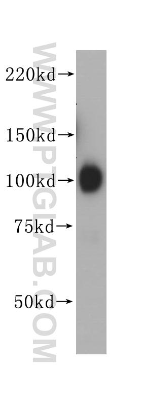 HeLa cells were subjected to SDS PAGE followed by western blot with 14700-1-AP(HSP90B1 antibody) at dilution of 1:500  incubated at room temperature for 1.5 hours