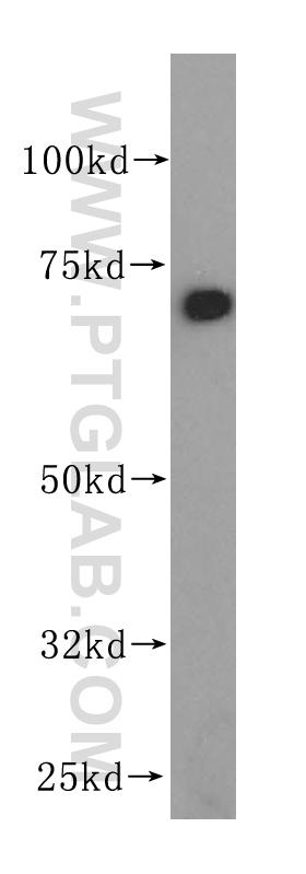 HepG2 cells were subjected to SDS PAGE followed by western blot with 14712-1-AP(PDIA4 antibody) at dilution of 1:500  incubated at room temperature for 1.5 hours