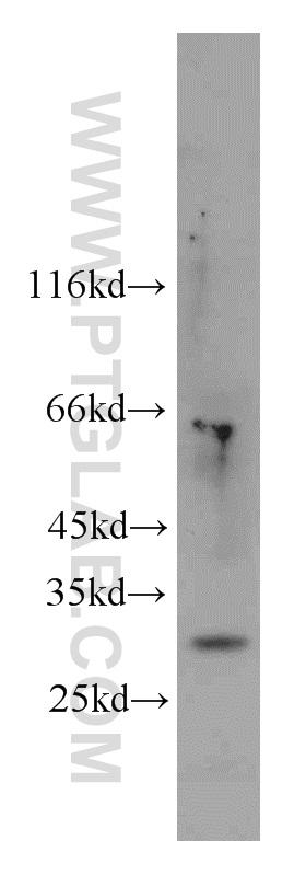 RAW264.7 cells were subjected to SDS PAGE followed by western blot with 15204-1-AP(CHOP; GADD153 antibody) at dilution of 1:1000  incubated at room temperature for 1.5 hours