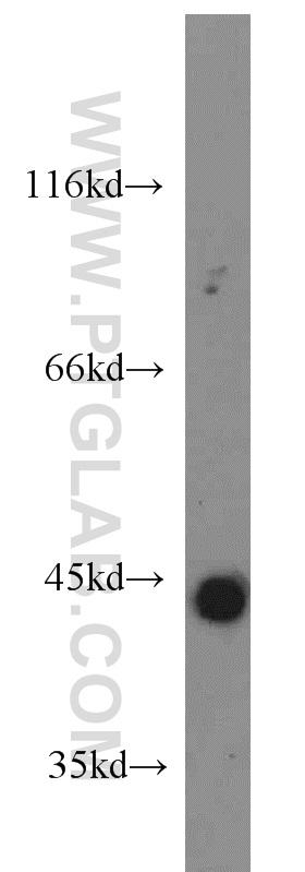 Recombinant protein were subjected to SDS PAGE followed by western blot with 15365-1-AP(IFNG antibody) at dilution of 1:2000  incubated at room temperature for 1.5 hours