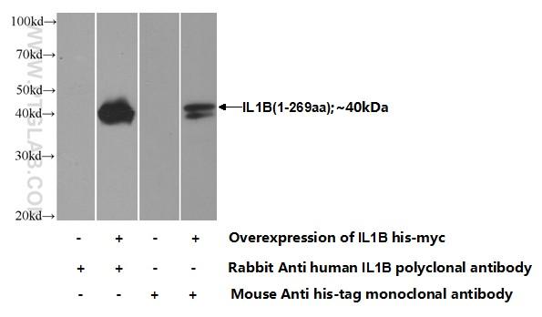 Transfected HEK-293 cells were subjected to SDS PAGE followed by western blot with 16806-1-AP( IL1B Antibody) at dilution of 1:700  incubated at room temperature for 1.5 hours