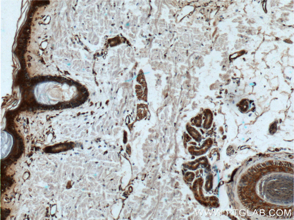 Immunohistochemistry of paraffin-embedded human skin tissue slide using 16806-1-AP( IL1B Antibody) at dilution of 1:200 (under 10x lens).