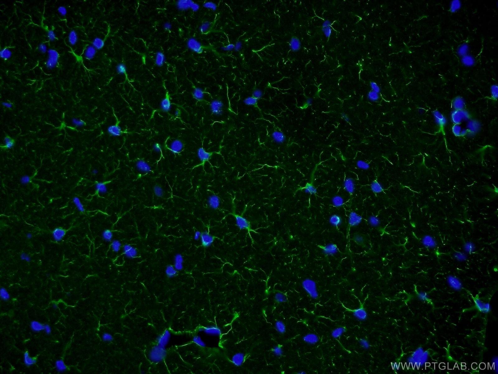 Immunofluorescent analysis of ( 4% PFA ) fixed mouse brain tissue using 16825-1-AP( GFAP Antibody) at dilution of 1:100 and Alexa Fluor 488-congugated AffiniPure Goat Anti-Rabbit IgG(H+L)