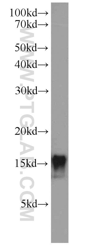 human adipose tissue were subjected to SDS PAGE followed by western blot with 17436-1-AP(LEP antibody) at dilution of 1:300  incubated at room temperature for 1.5 hours