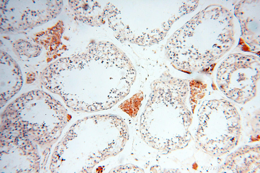 Immunohistochemical of  paraffin-embedded human testis using 17797-1-AP(INPP5E antibody) at dilution of 1:50 (under 10x lens)