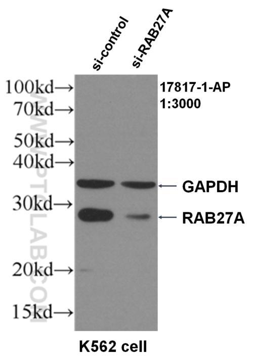 WB result of RAB27A antibody (17817-1-AP, 1:3000) with si-Control and si-RAB7B transfected K562 cells.