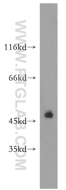 HEK-293 cells were subjected to SDS PAGE followed by western blot with 18106-1-AP(PD-1 antibody) at dilution of 1:500  incubated at room temperature for 1.5 hours