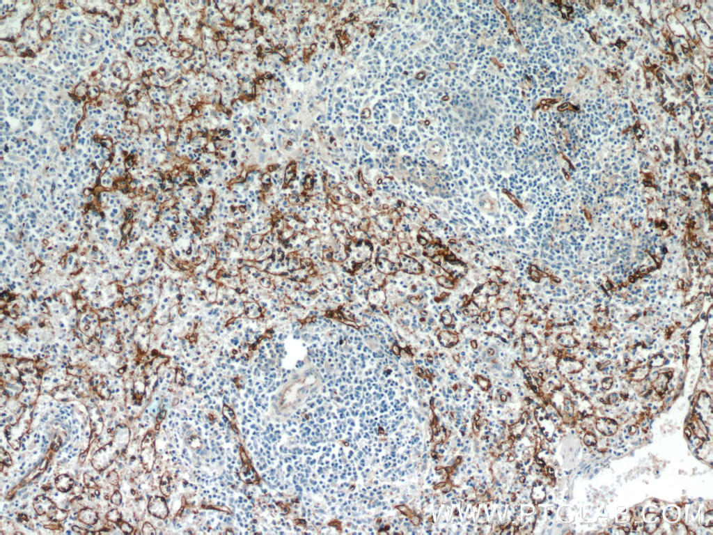 Immunohistochemical of  paraffin-embedded human spleen using 18836-1-AP(CD36 antibody) at dilution of 1:50 (under 10x lens)