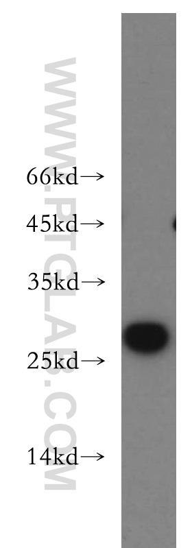 PC-3 cells were subjected to SDS PAGE followed by western blot with 20215-1-AP(IGF1B-Specific antibody) at dilution of 1:500  incubated at room temperature for 1.5 hours