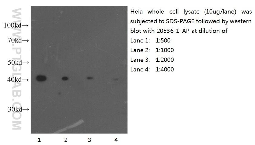 HeLa 細胞ライセート（10 ug/レーン）を SDS-PAGE で分離し、様々な倍率で希釈した抗 ACTB 抗体（品番： 20536-1-AP）でアクチンを検出した。