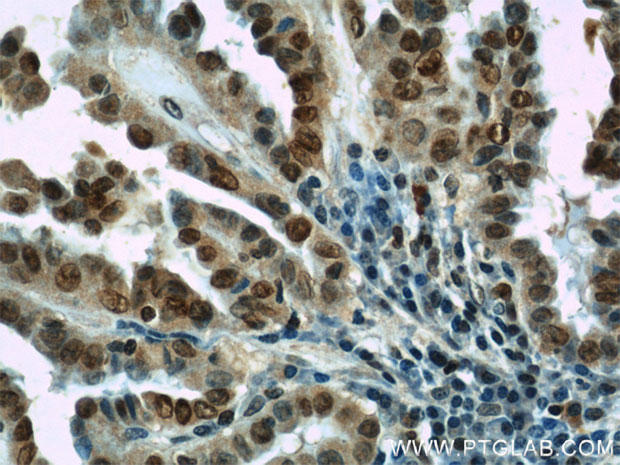 HIF1aplha_antibody_pgi_image