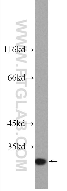 Recombinant protein were subjected to SDS PAGE followed by western blot with 21865-1-AP( IL6 Antibody) at dilution of 1:3000  incubated at room temperature for 1.5 hours
