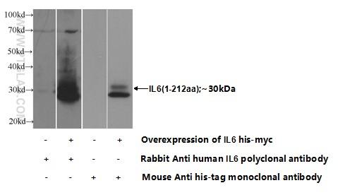 Transfected HEK-293 cells were subjected to SDS PAGE followed by western blot with 21865-1-AP( IL6 Antibody) at dilution of 1:1000  incubated at room temperature for 1.5 hours