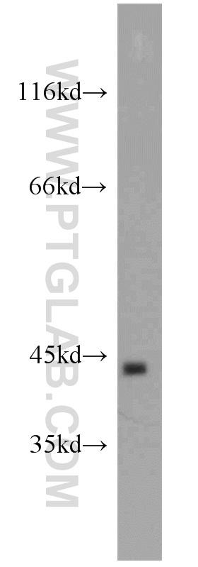 COLO 320 細胞ライセートを SDS-PAGE で分離し、Proteintech 社の抗 TBP 抗体（品番： 22006-1-AP、1：1500 希釈）を使用して、TBP タンパク質をウェスタンブロットで検出した。