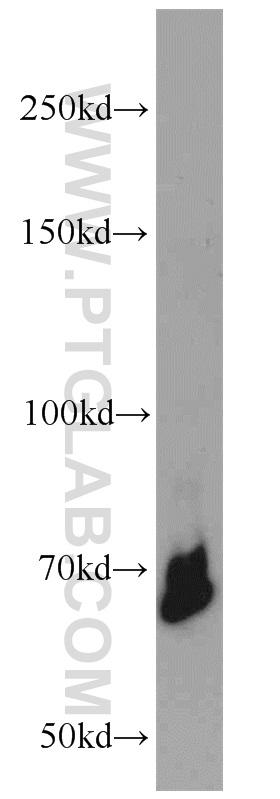 Jurkat cells were subjected to SDS PAGE followed by western blot with 22156-1-AP(YY1 antibody) at dilution of 1:1000  incubated at room temperature for 1.5 hours