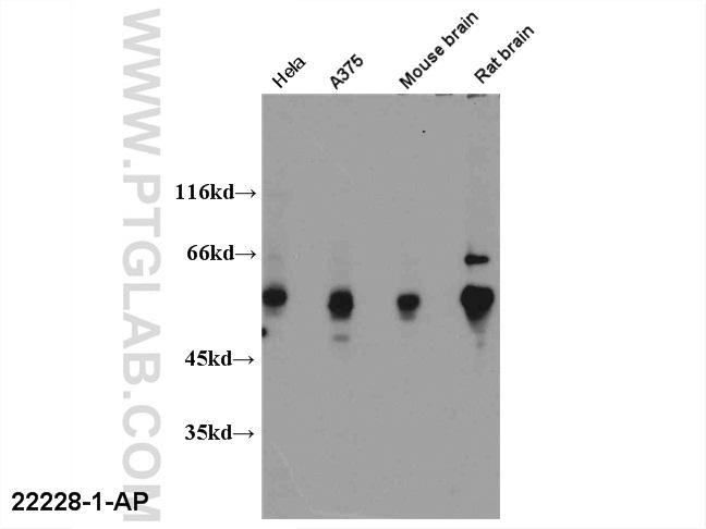 WB results of 22228-1-AP(FOXP3 antibody).