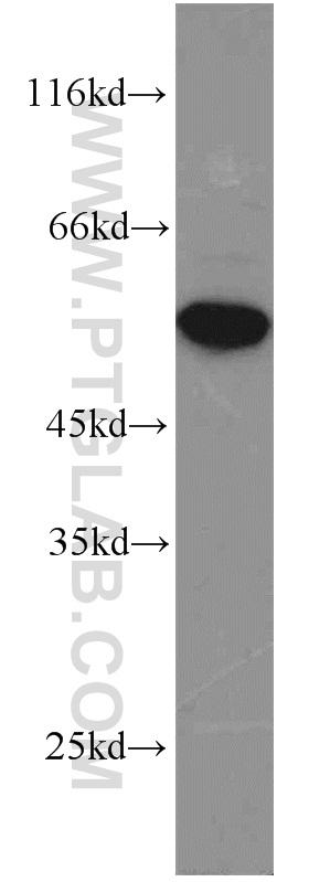 HeLa cells were subjected to SDS PAGE followed by western blot with 22228-1-AP(FOXP3 antibody) at dilution of 1:2000  incubated at room temperature for 1.5 hours