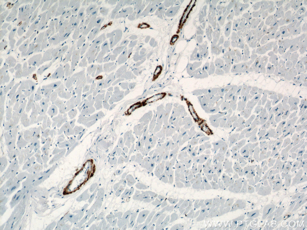 Immunohistochemical of  paraffin-embedded human heart using 23081-1-AP(ACTA2 antibody) at dilution of 1:500 (under 10x lens)