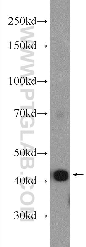 rat skeletal muscle tissue were subjected to SDS PAGE followed by western blot with 23660-1-AP( ACTA1 Antibody) at dilution of 1:4000  incubated at room temperature for 1.5 hours
